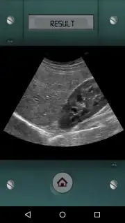 Scanner X-ray screenshot 3