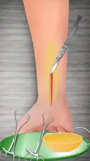 WristSurgeryDoctor screenshot 16